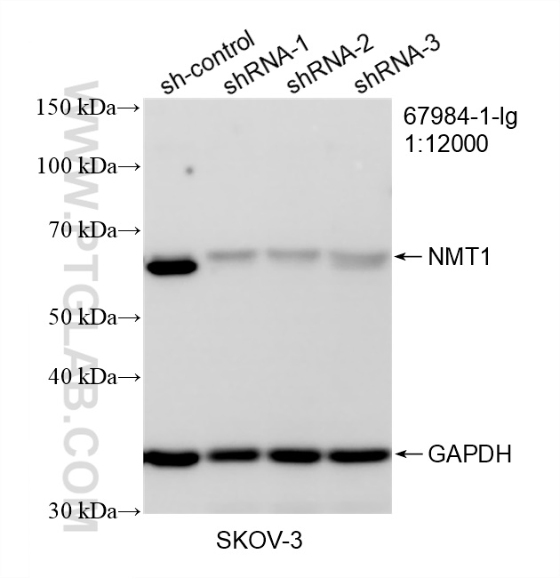 WB analysis of SKOV-3 using 67984-1-Ig