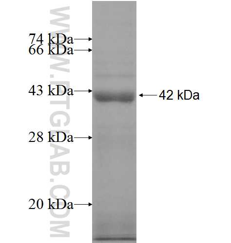 NMT2 fusion protein Ag8425 SDS-PAGE