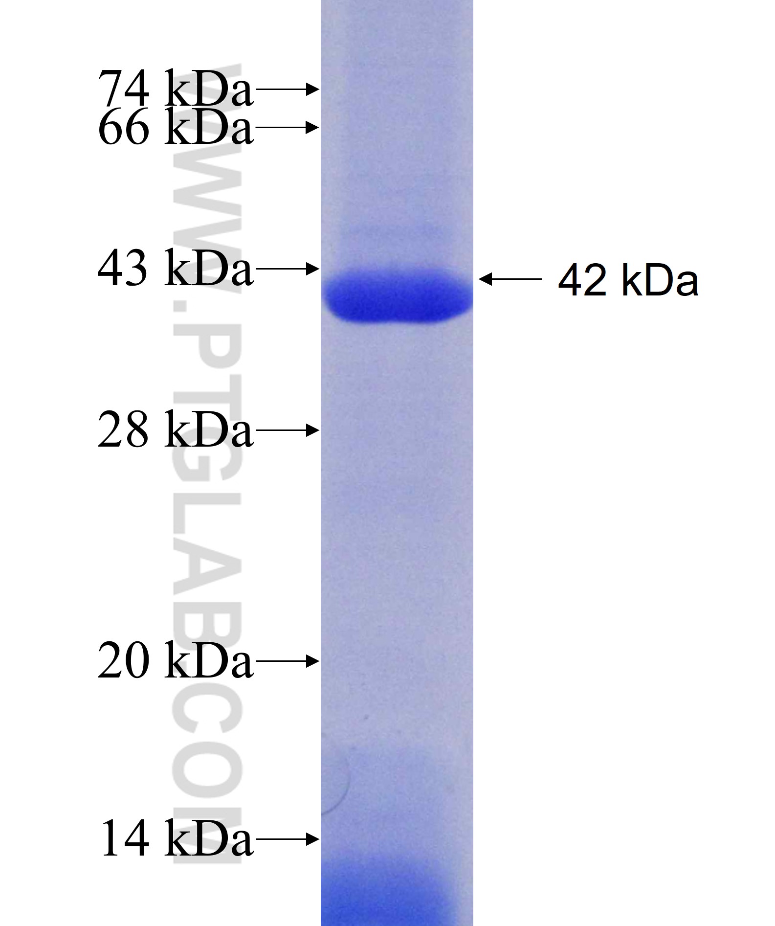 NMT2 fusion protein Ag8425 SDS-PAGE