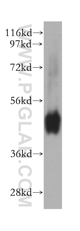 WB analysis of human colon using 14619-1-AP