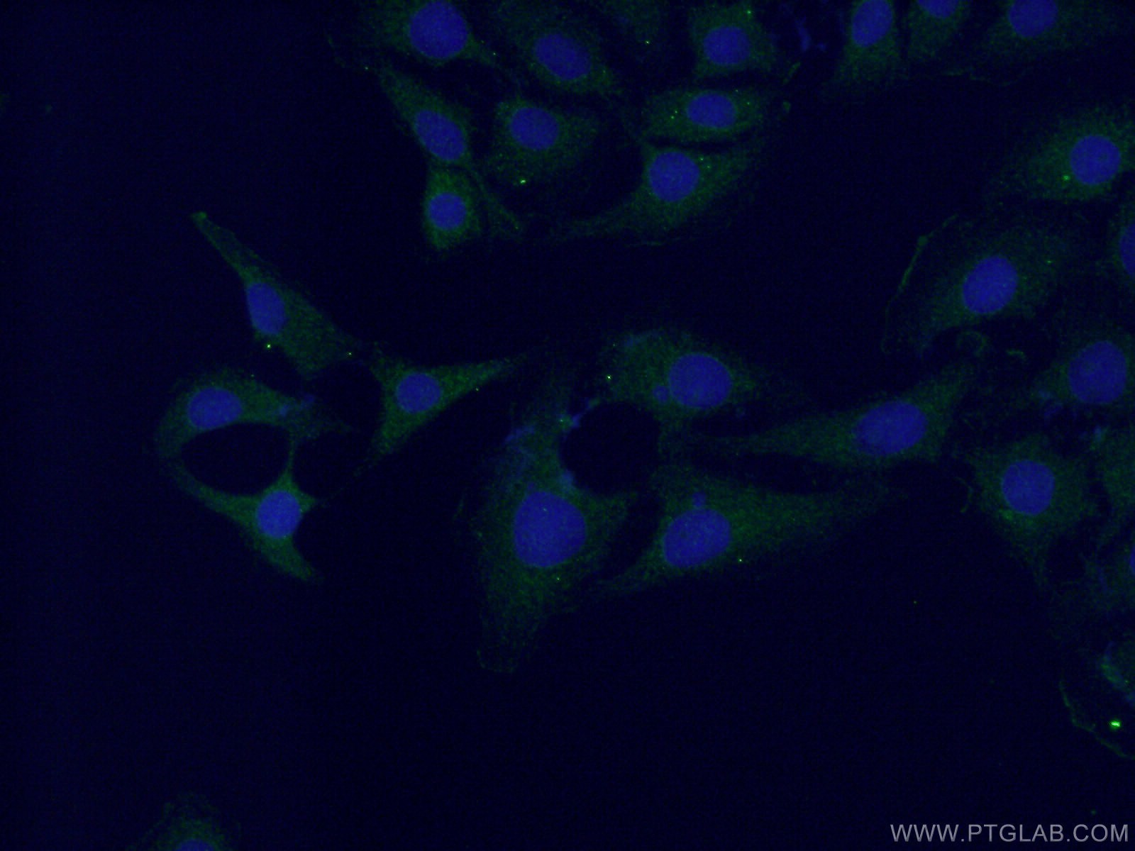 IF Staining of SH-SY5Y using 26905-1-AP