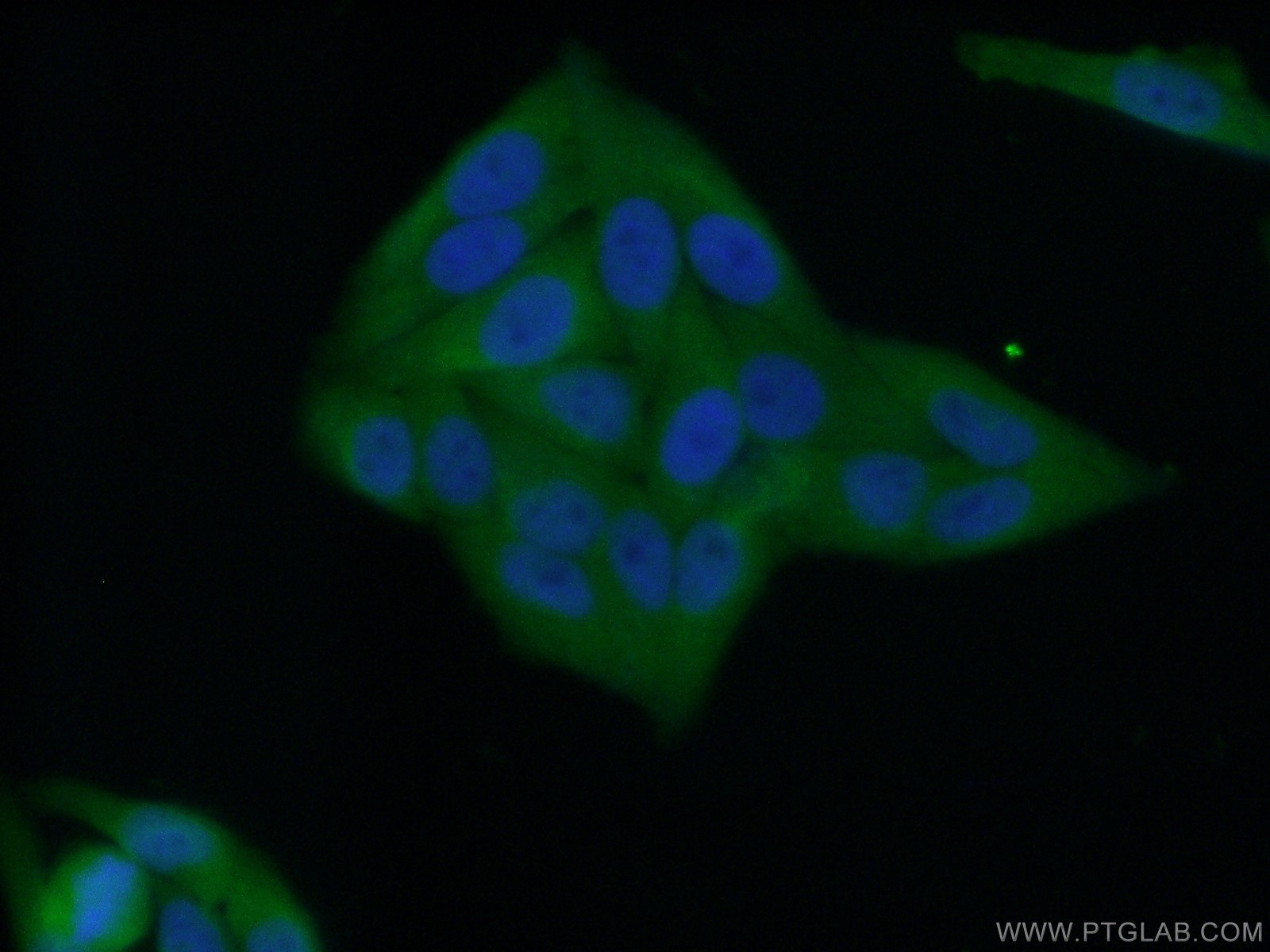 IF Staining of HepG2 using 15123-1-AP