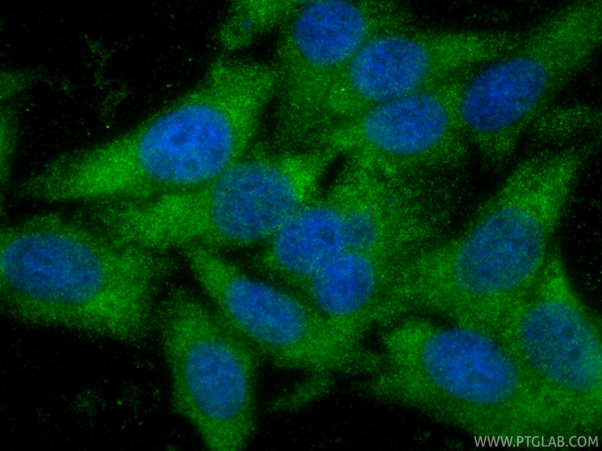 IF Staining of HepG2 using 84876-9-RR (same clone as 84876-9-PBS) IF Staining of HepG2 using 84876-9-RR (same clone as 84876-9-PBS)