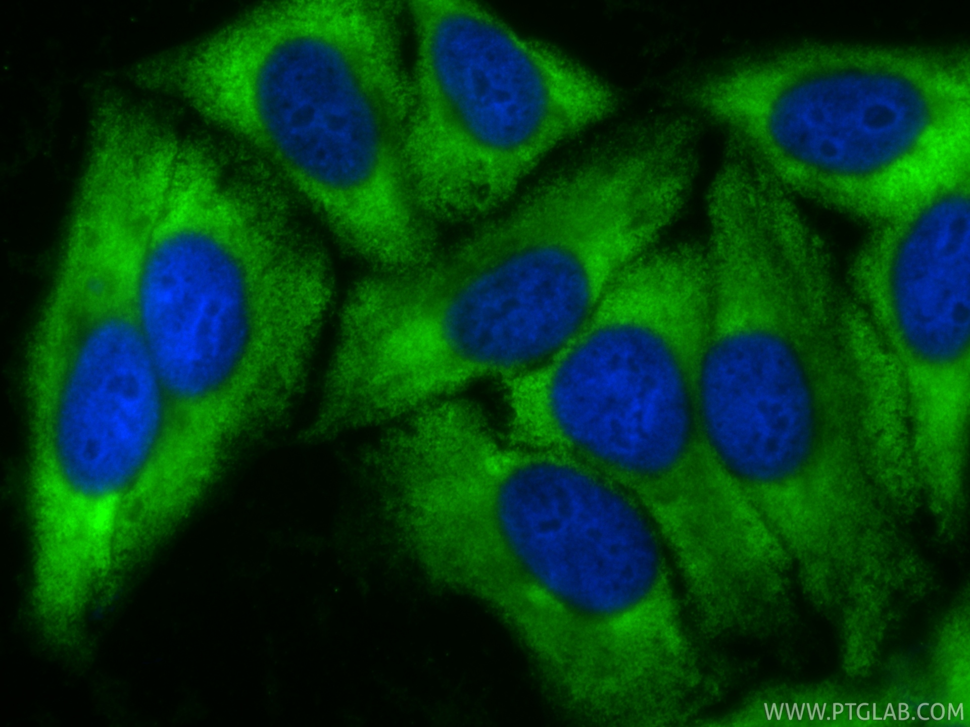 IF Staining of HepG2 using CL488-84876-9