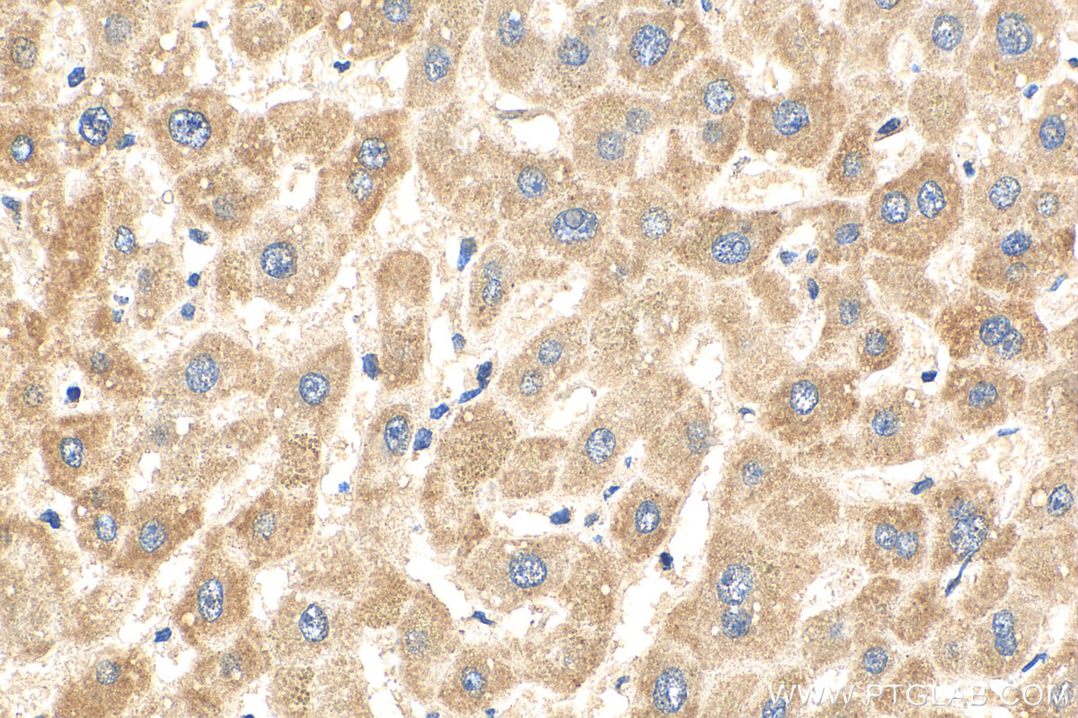 IHC staining of human liver using 68194-1-Ig (same clone as 68194-1-PBS)