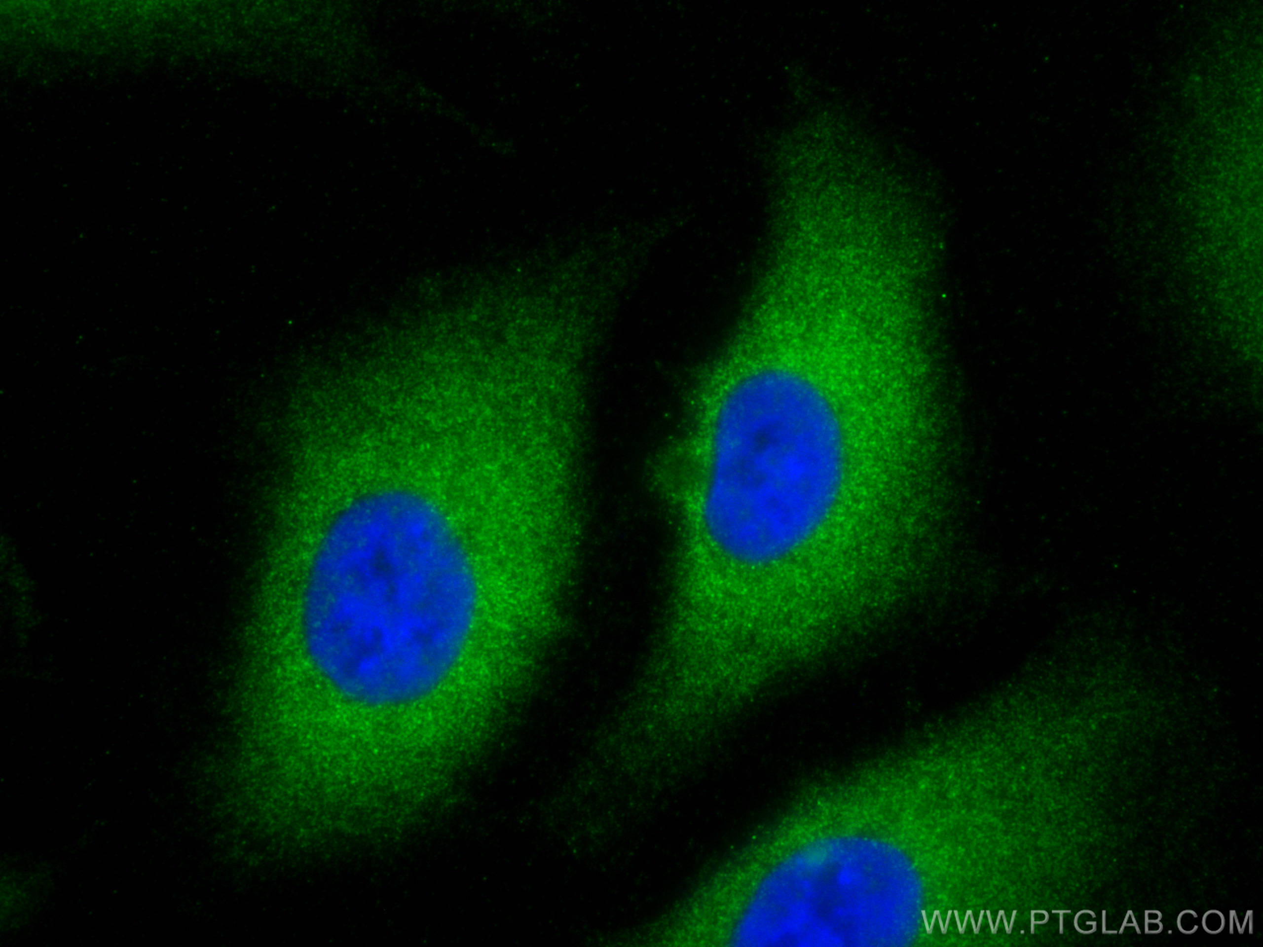 IF Staining of A549 using 10091-2-AP