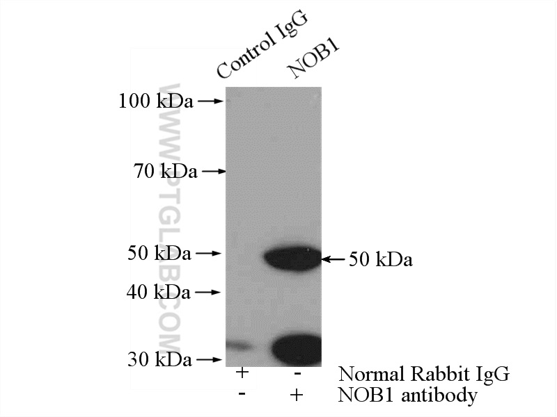 IP experiment of HepG2 using 10091-2-AP