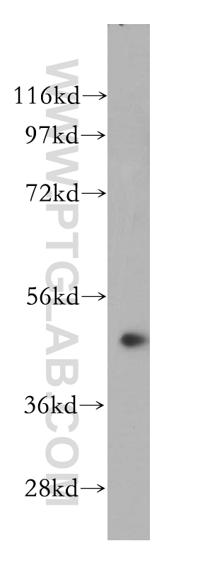 WB analysis of Jurkat using 14456-1-AP