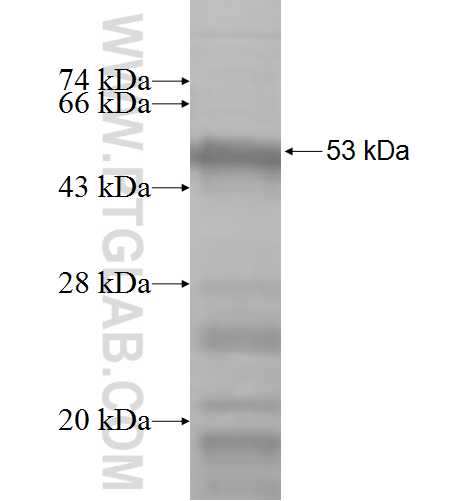 NOB1 fusion protein Ag6807 SDS-PAGE NOB1 fusion protein Ag6807 SDS-PAGE