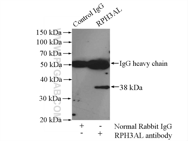IP experiment of HepG2 using 15297-1-AP