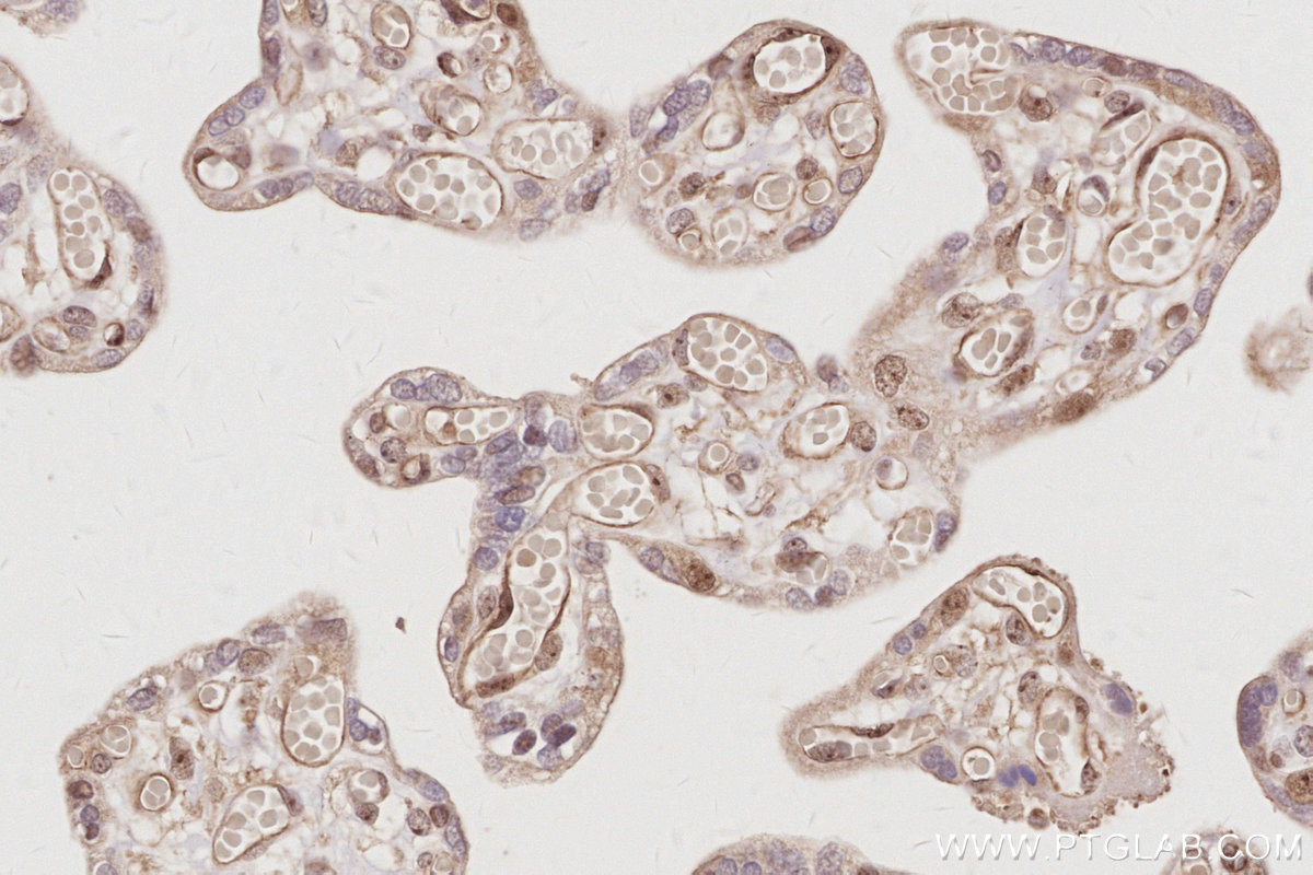 IHC staining of human placenta using 28509-1-AP IHC staining of human placenta using 28509-1-AP