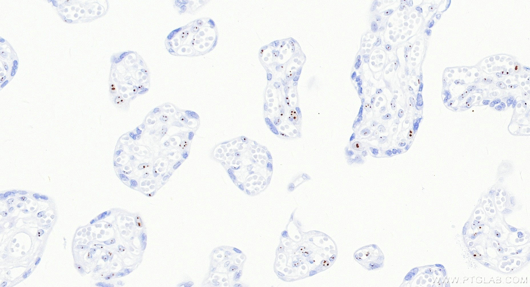 IHC staining of human placenta using 88267-1-RR IHC staining of human placenta using 88267-1-RR