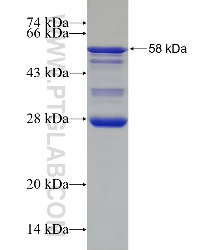 NOC2L fusion protein Ag26952 SDS-PAGE
