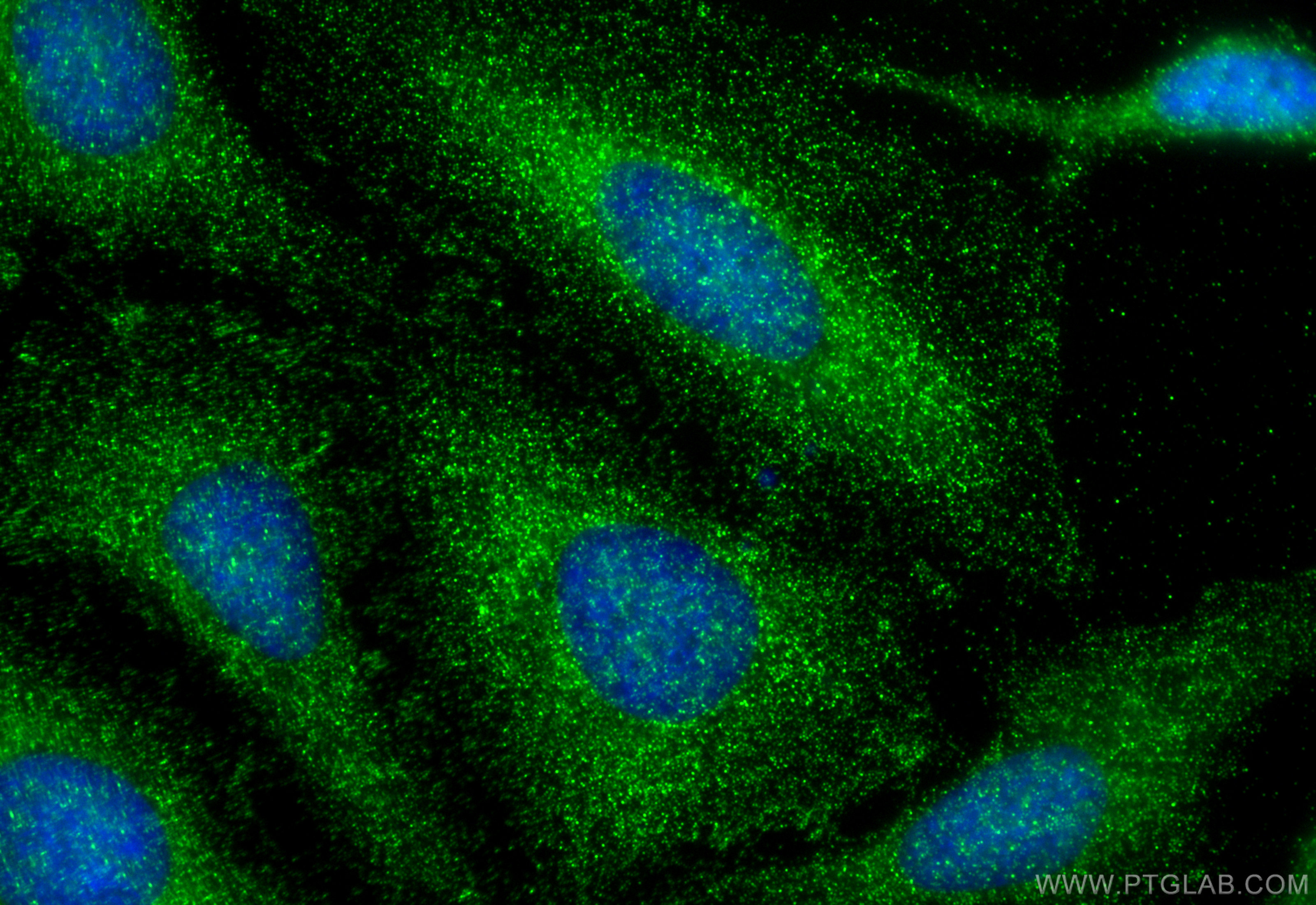 IF Staining of HeLa using 30628-1-AP
