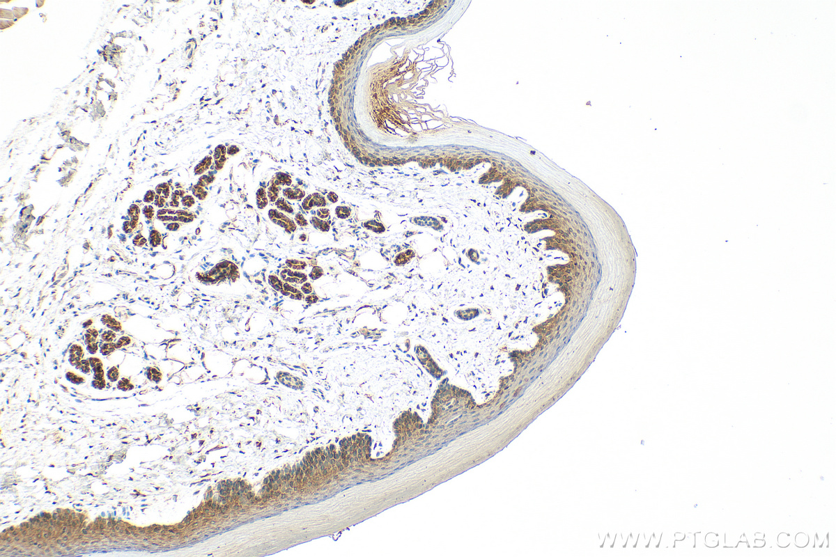 IHC staining of mouse skin using 30628-1-AP