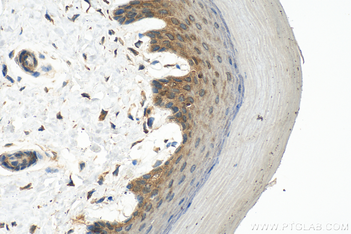 IHC staining of mouse skin using 30628-1-AP