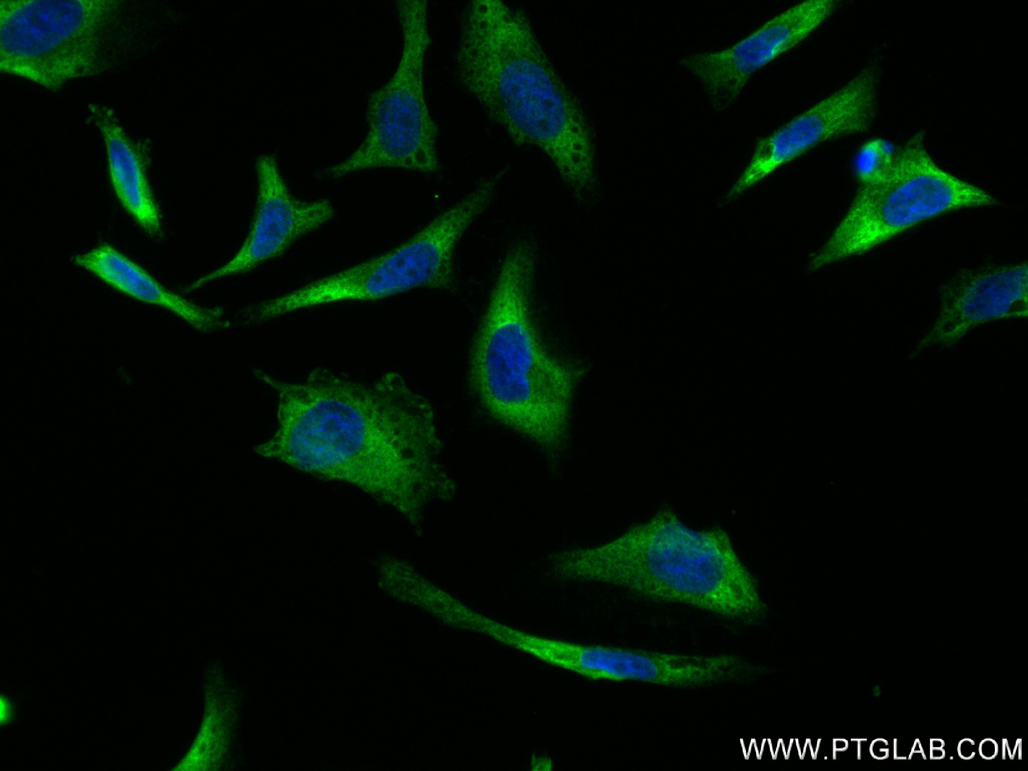 IF Staining of HeLa using 83281-3-RR