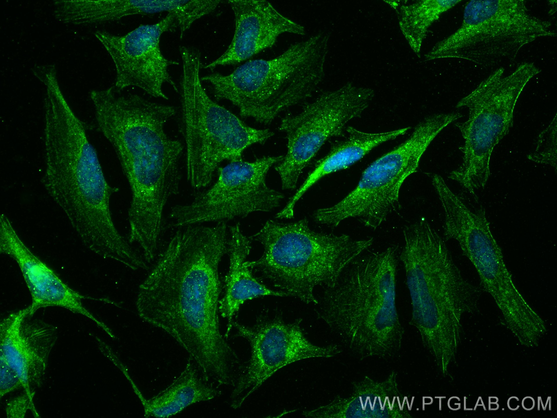 IF Staining of HeLa using 27430-1-AP