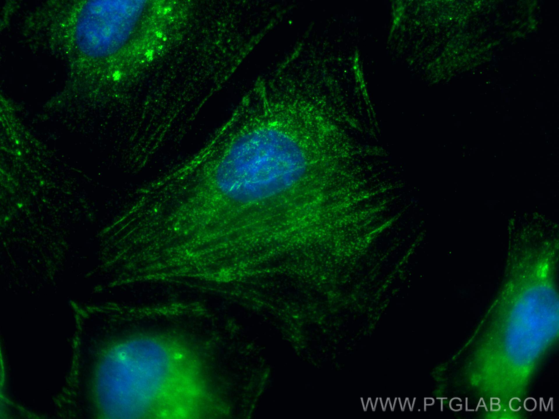 IF Staining of HeLa using 27430-1-AP