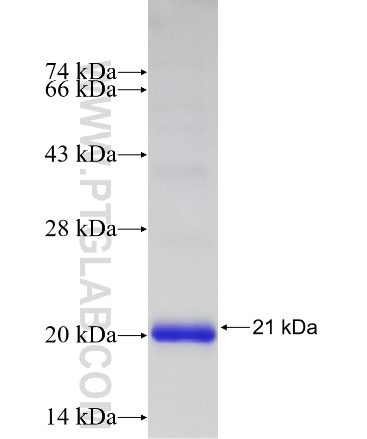 NODAL fusion protein Ag26736 SDS-PAGE NODAL fusion protein Ag26736 SDS-PAGE