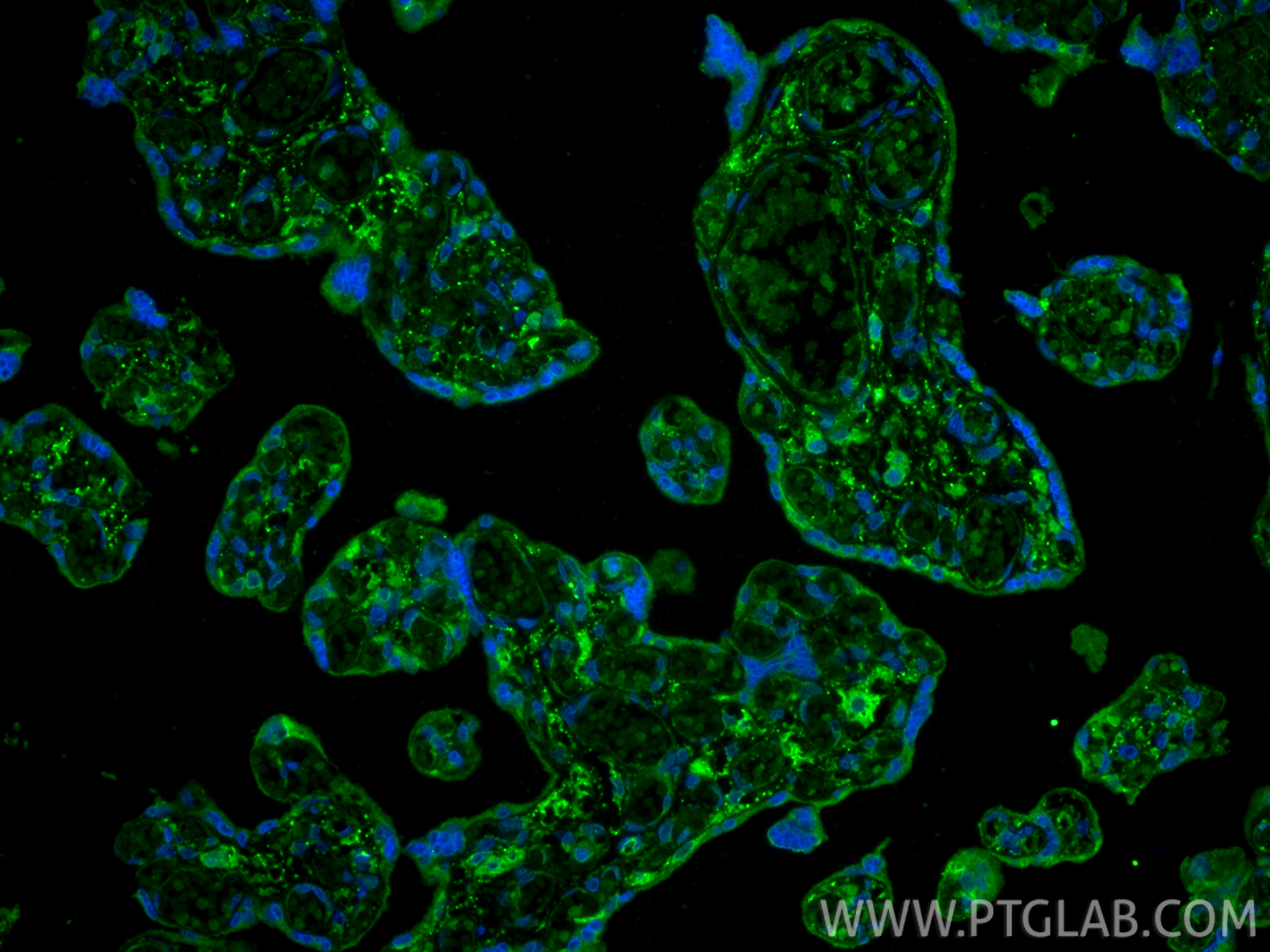 IF Staining of human placenta using 30023-1-AP