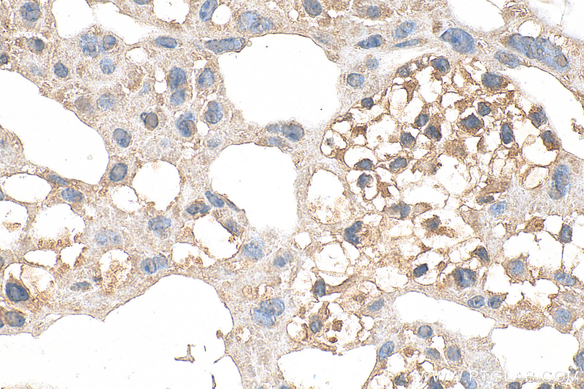 IHC staining of mouse placenta using 30023-1-AP
