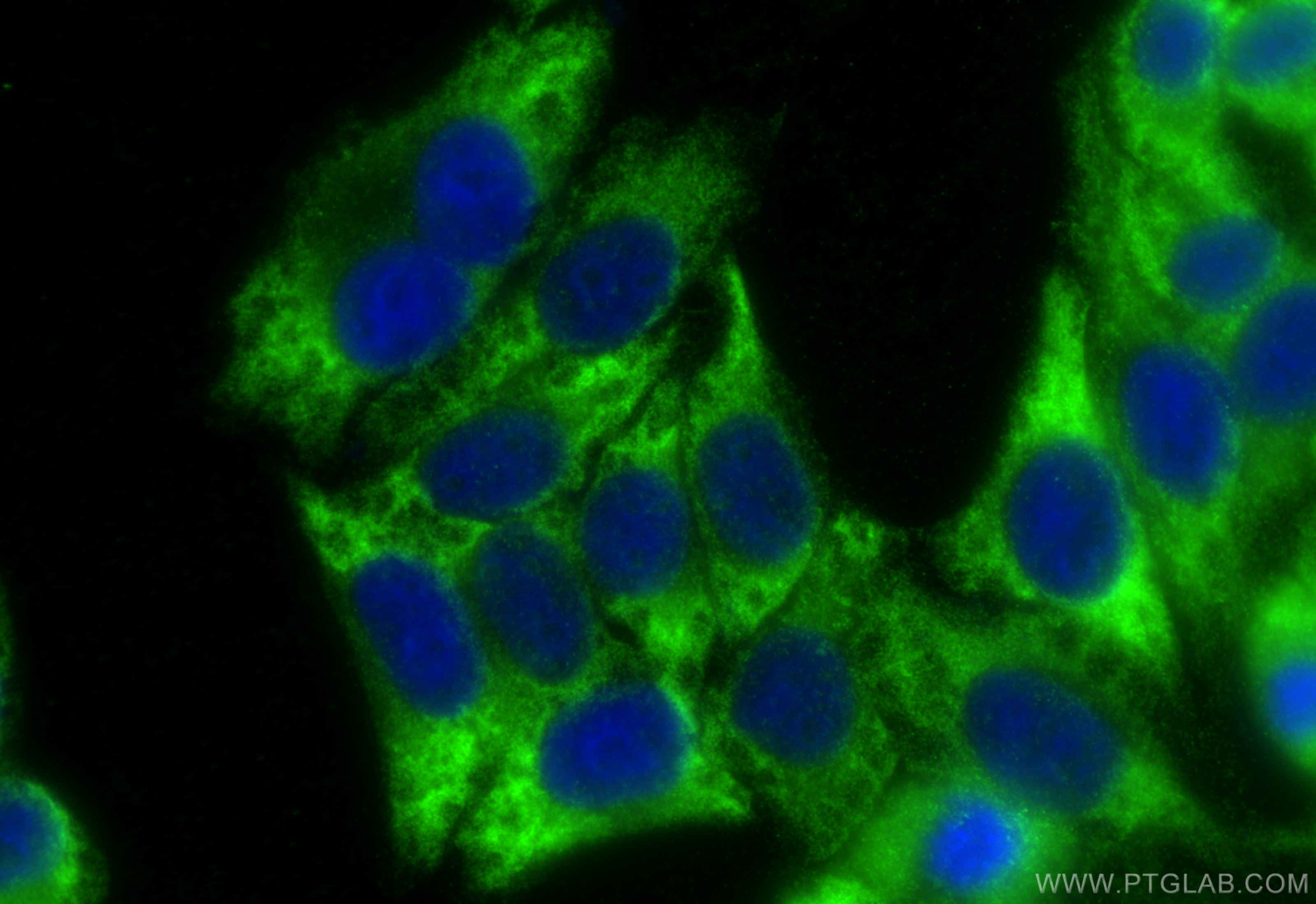 IF Staining of HepG2 using 10846-2-AP (same clone as 10846-2-PBS)