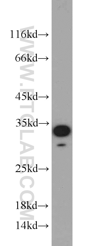 WB analysis of mouse skeletal muscle using 10846-2-AP (same clone as 10846-2-PBS)