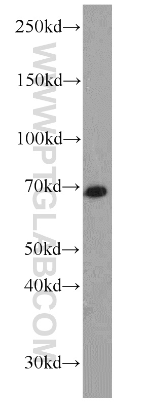 WB analysis of mouse brain using 14802-1-AP