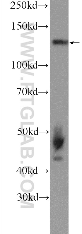 WB analysis of SGC-7901 using 15706-1-AP