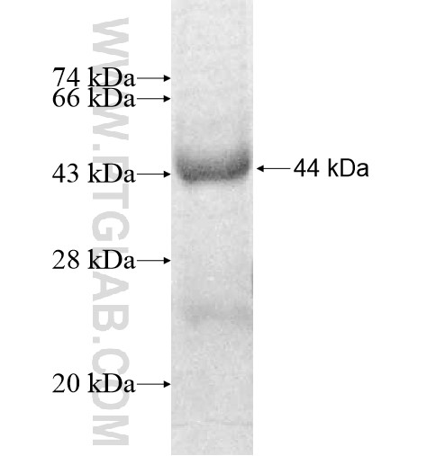 NOL9 fusion protein Ag9169 SDS-PAGE NOL9 fusion protein Ag9169 SDS-PAGE