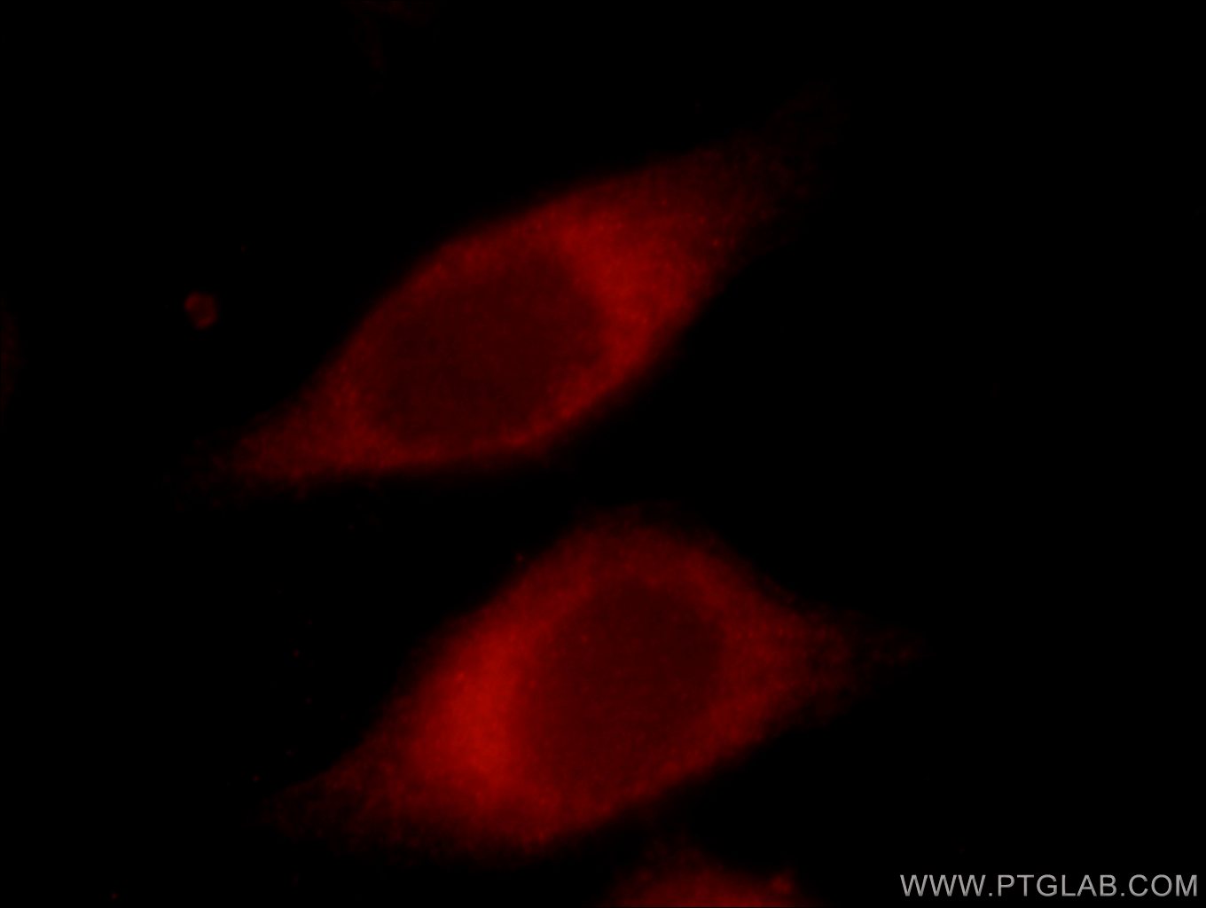 IF Staining of MCF-7 using 17792-1-AP