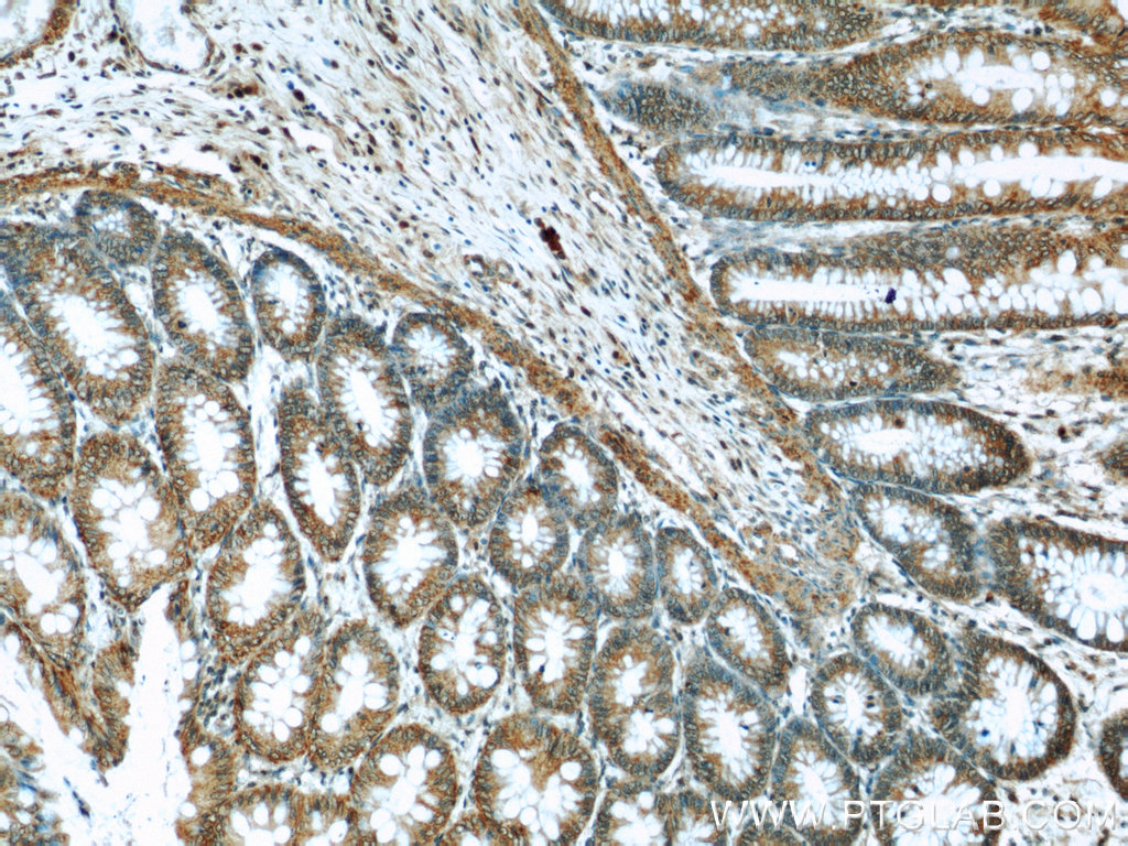 IHC staining of human colon using 17792-1-AP