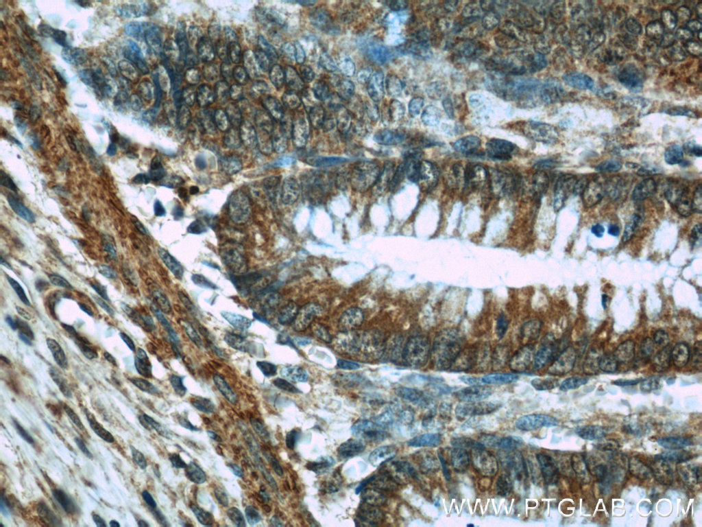 IHC staining of human colon using 17792-1-AP