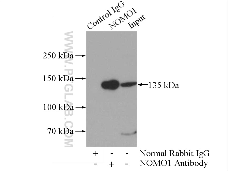 IP experiment of A431 using 17792-1-AP