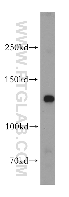 WB analysis of mouse colon using 17792-1-AP