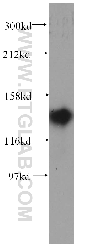 WB analysis of BxPC-3 using 14328-1-AP
