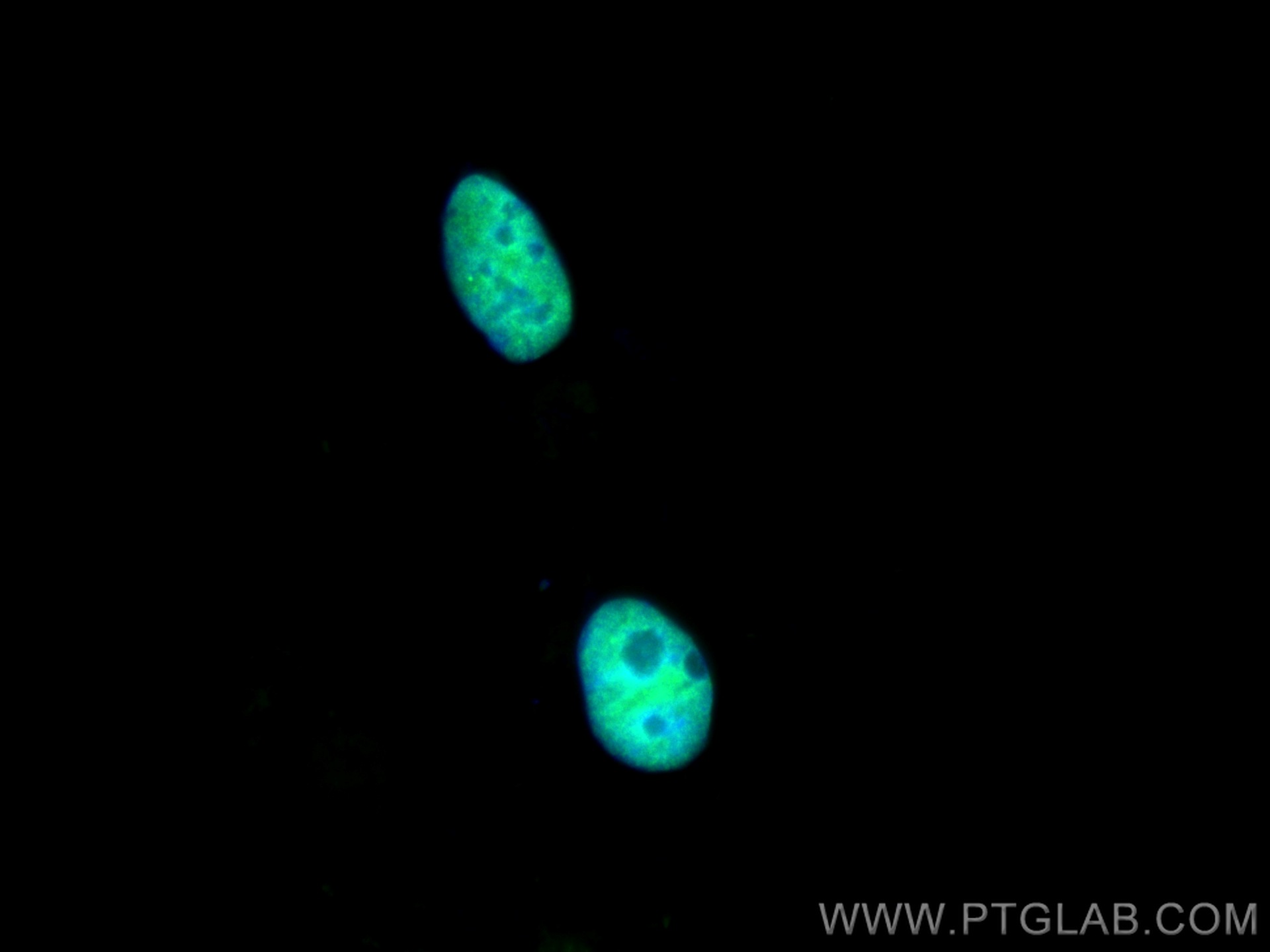 IF Staining of HEK-293 using 11058-1-AP