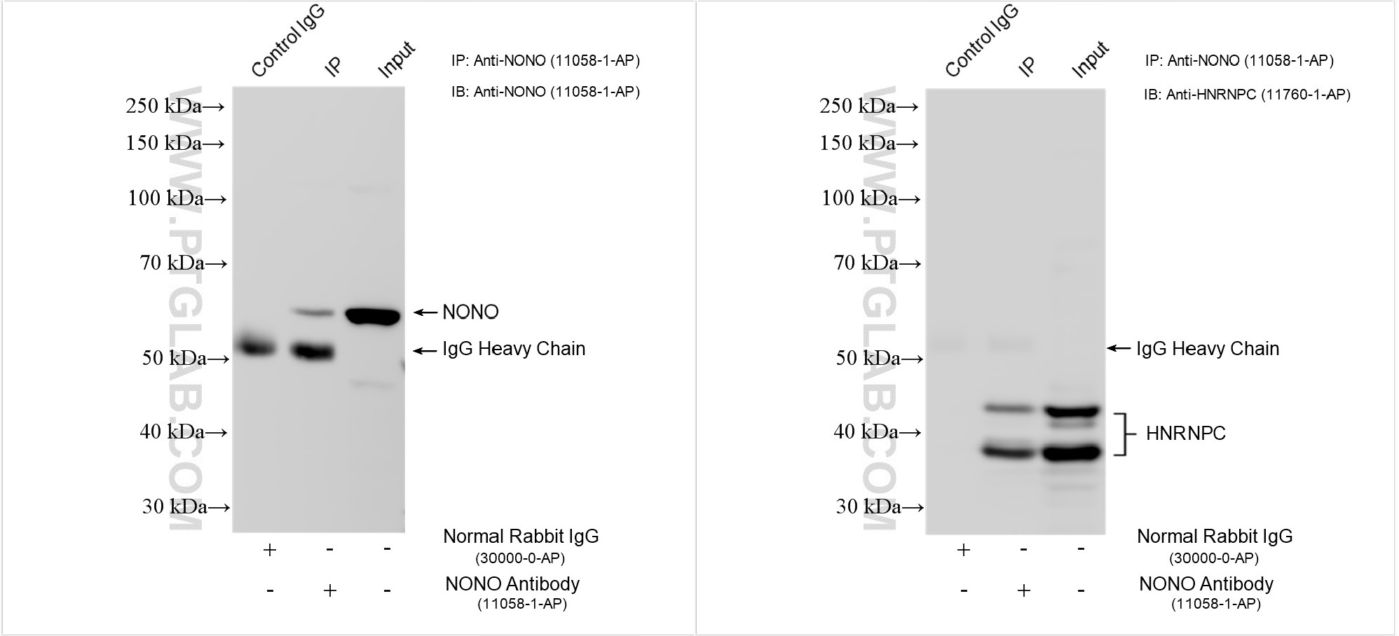 IP experiment of HEK-293T using 11058-1-AP