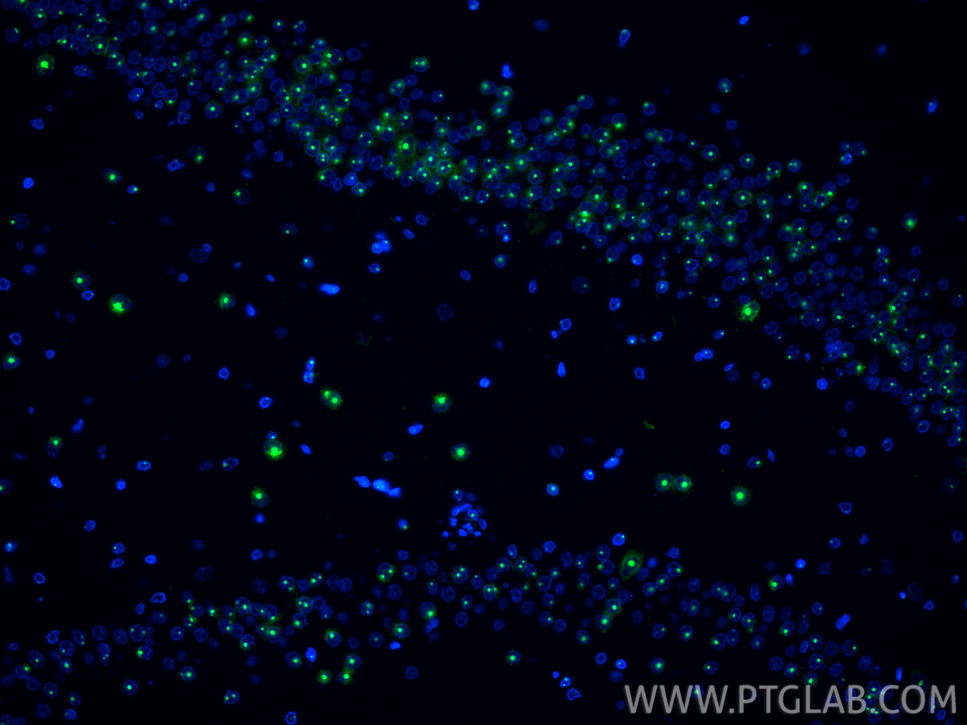 IF Staining of rat brain using 87529-1-RR IF Staining of rat brain using 87529-1-RR