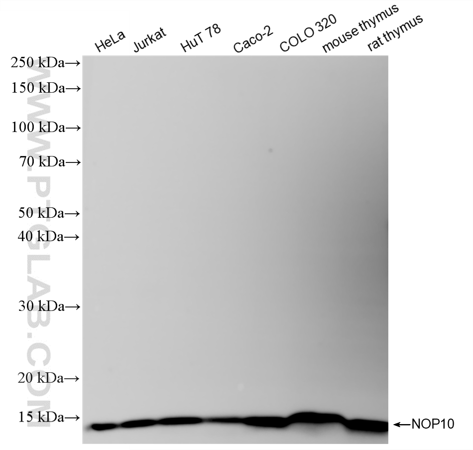 WB analysis using 87529-1-RR