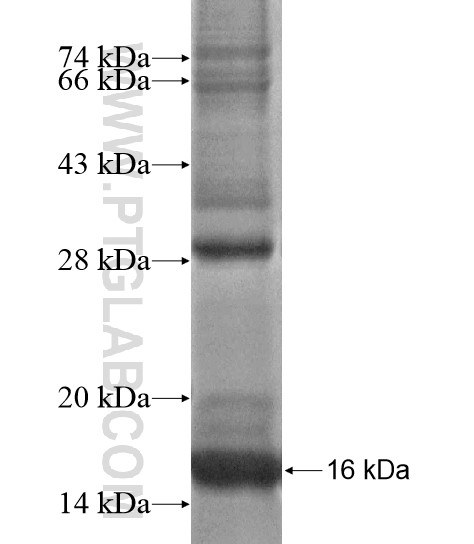 NOP10 fusion protein Ag18978 SDS-PAGE NOP10 fusion protein Ag18978 SDS-PAGE