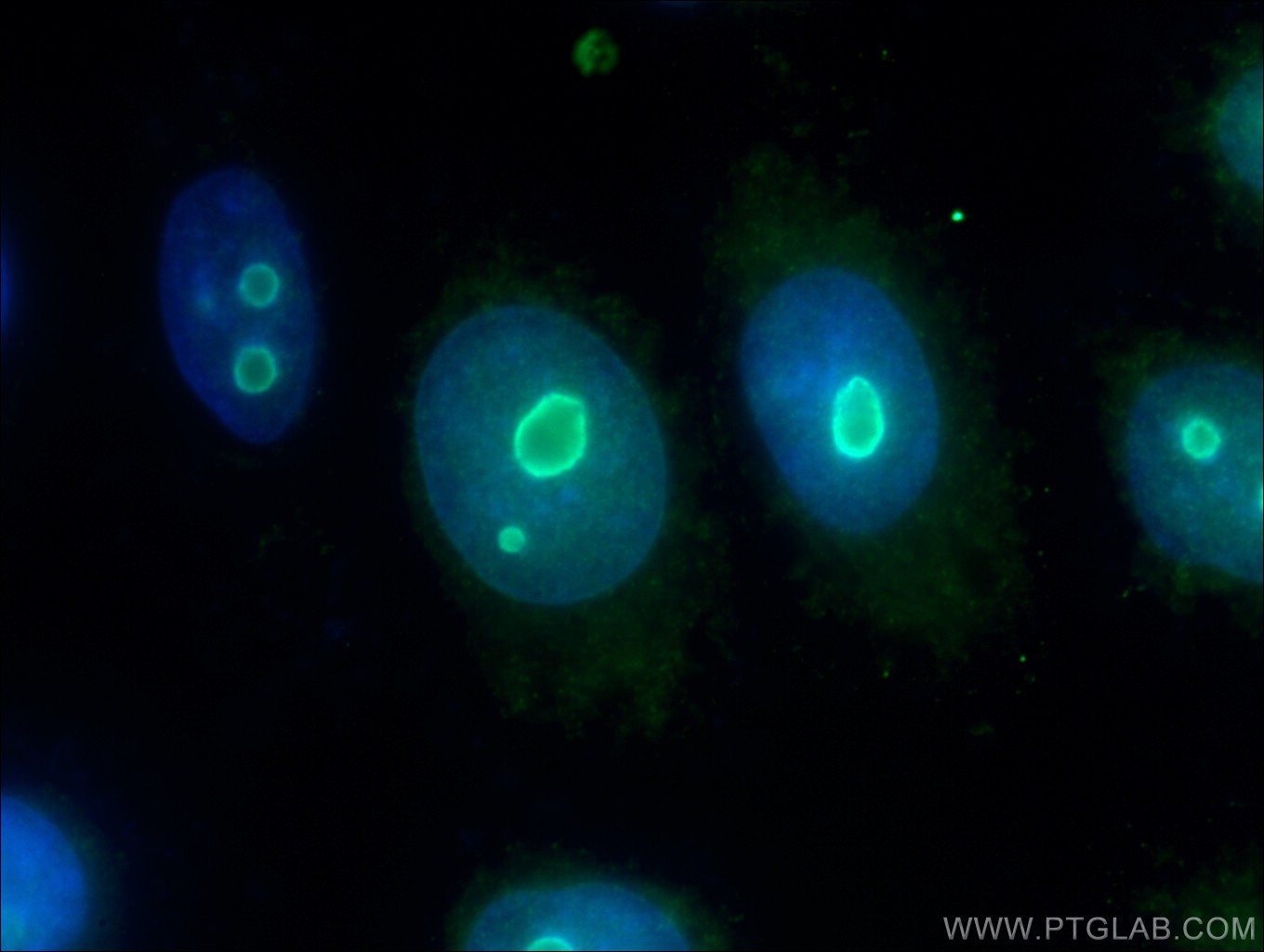 IF Staining of HepG2 using 26854-1-AP