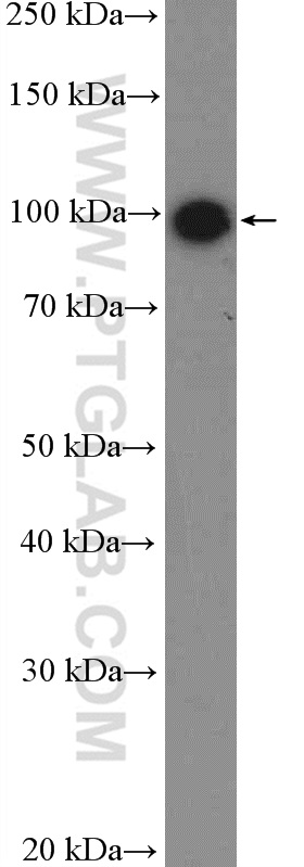 WB analysis of MDA-MB-453s using 26854-1-AP