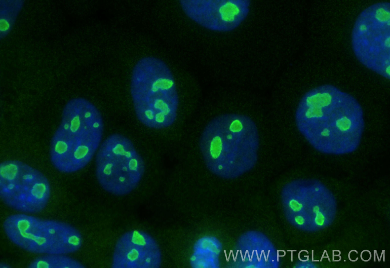 IF Staining of A431 using 31969-1-AP