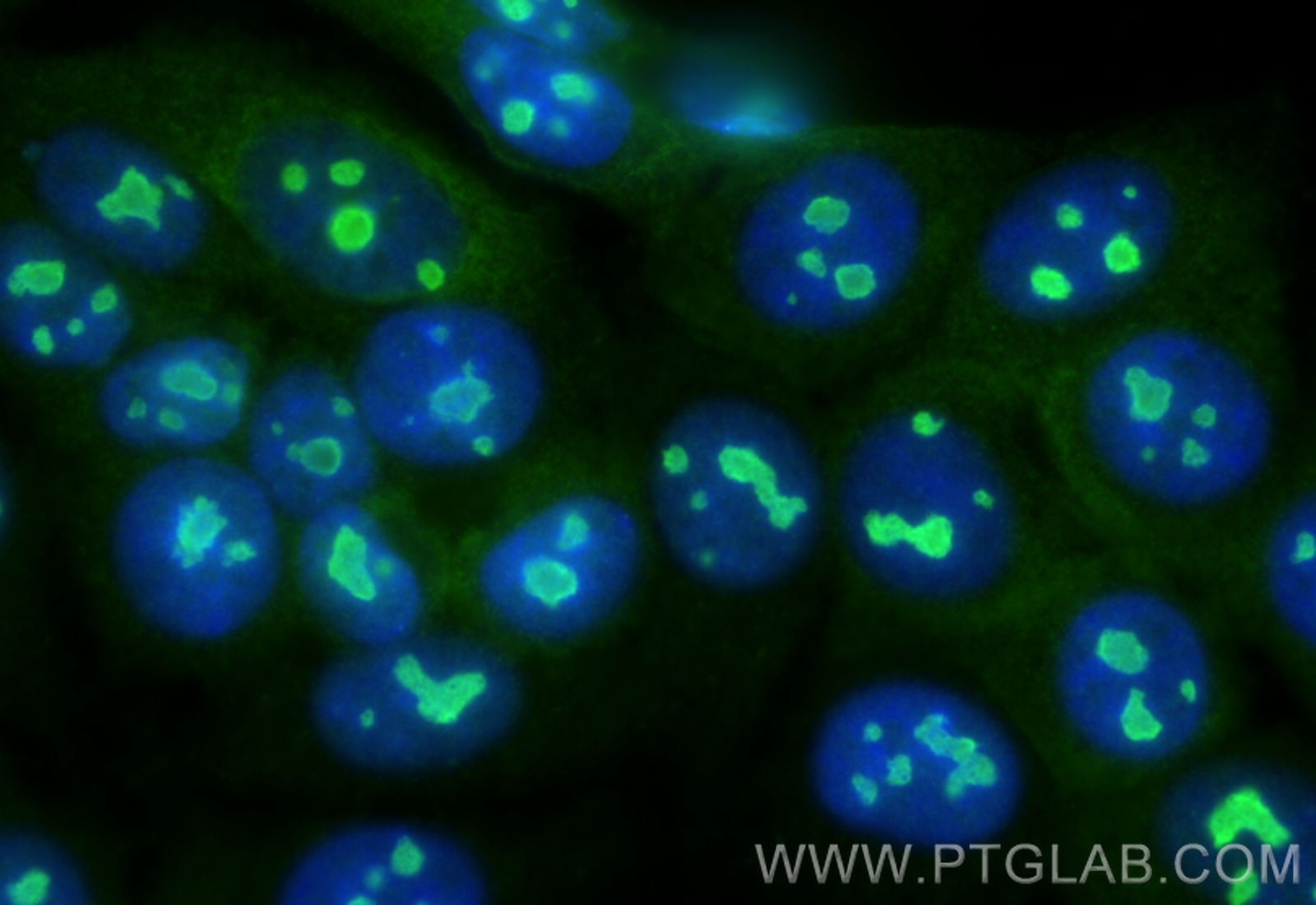 IF Staining of MCF-7 using 31969-1-AP
