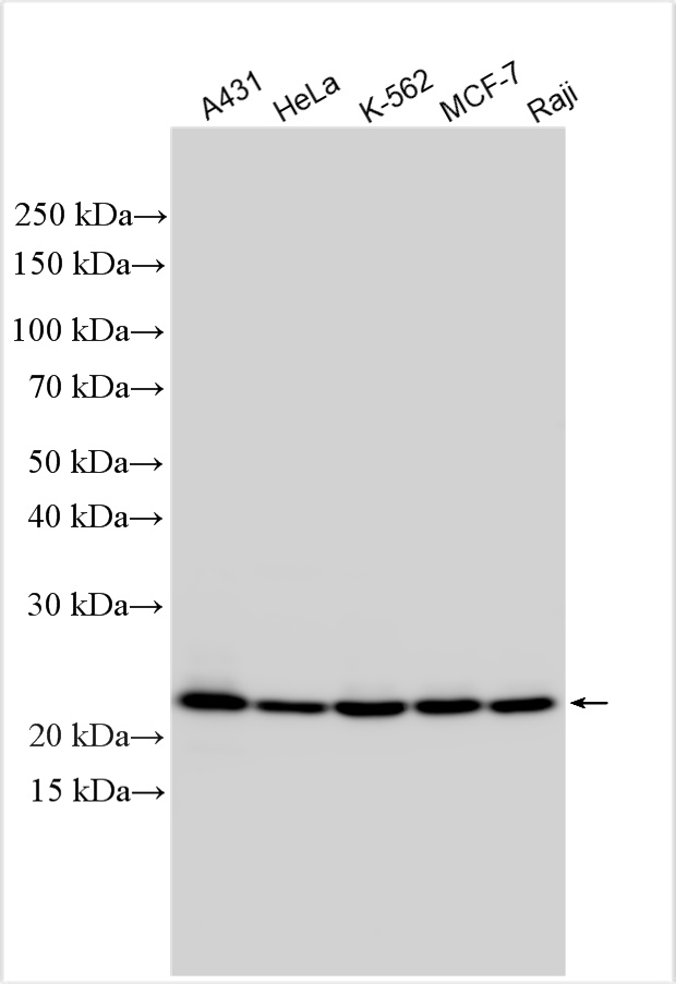 WB analysis using 31969-1-AP