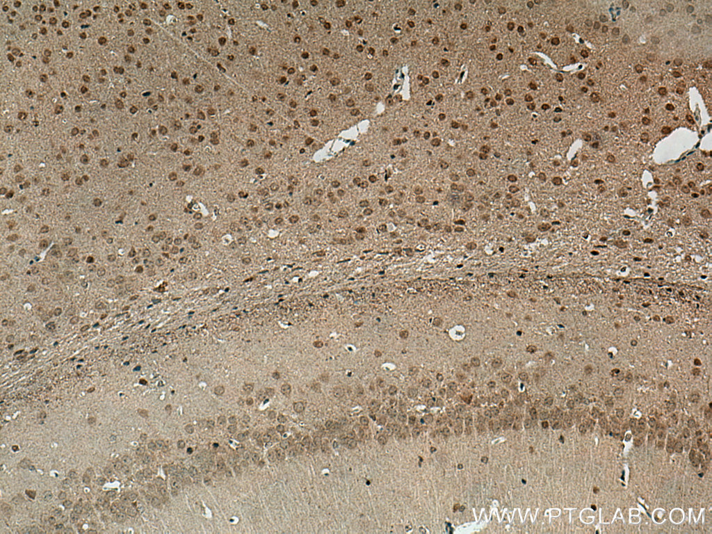 IHC staining of mouse brain using 10448-1-AP