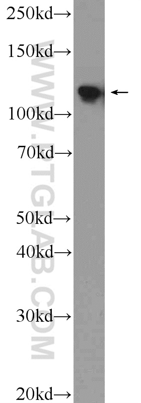 WB analysis of A2780 using 10448-1-AP