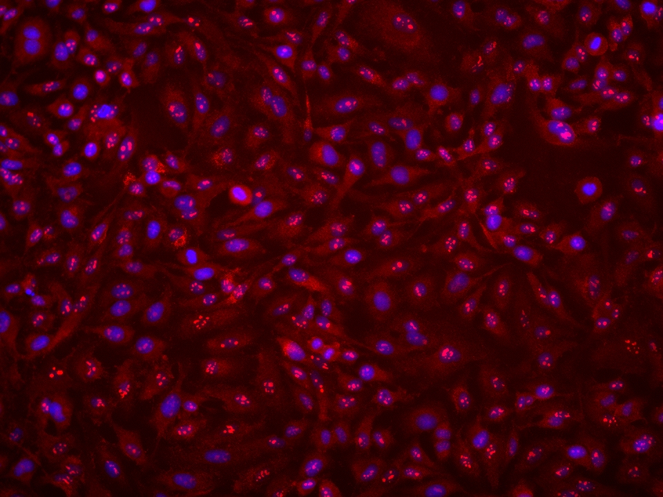 IF Staining of HeLa using 68889-1-Ig